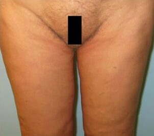 After Image