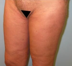 After Image