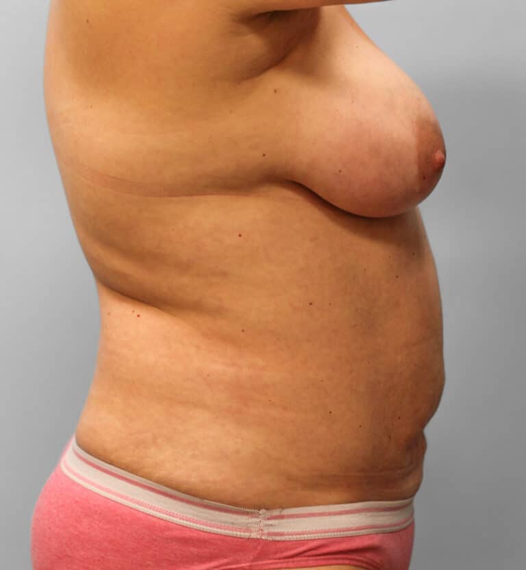 After Image