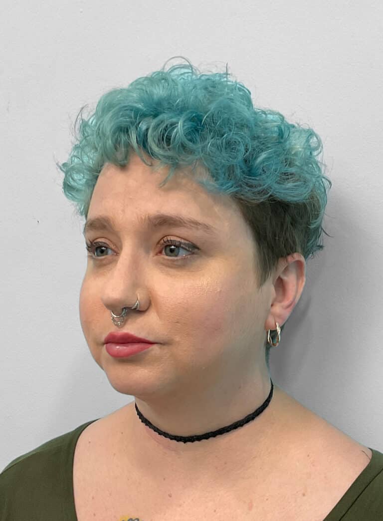 After Image: Restylane Kysse – Joy - left-front-oblique