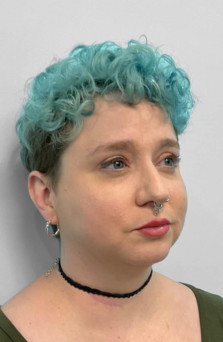 After Image: Restylane Kysse – Joy - right-front-oblique