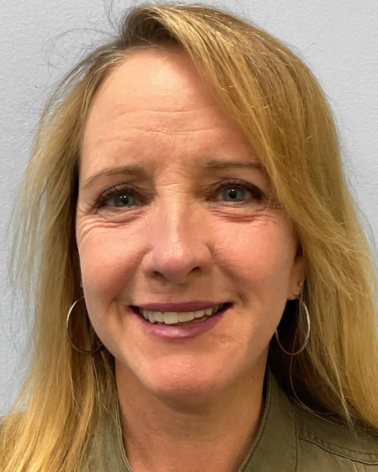 After Image: Facelift & TFX- Dr. Tucker - front