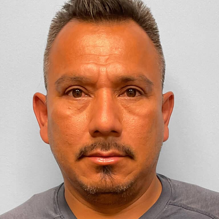 After Image: Upper & Lower Blepharoplasty – Dr. Tucker - front