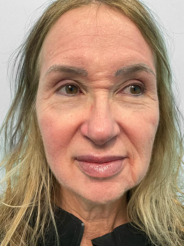 After Image: Lip Flip – Heather - front