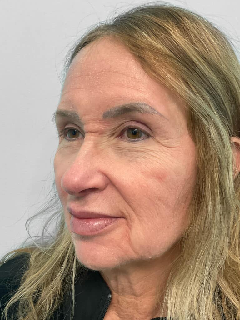 After Image: Lip Flip – Heather - left-front-oblique