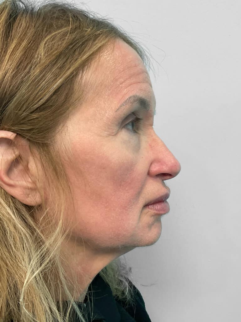 After Image: Lip Flip – Heather - right-side
