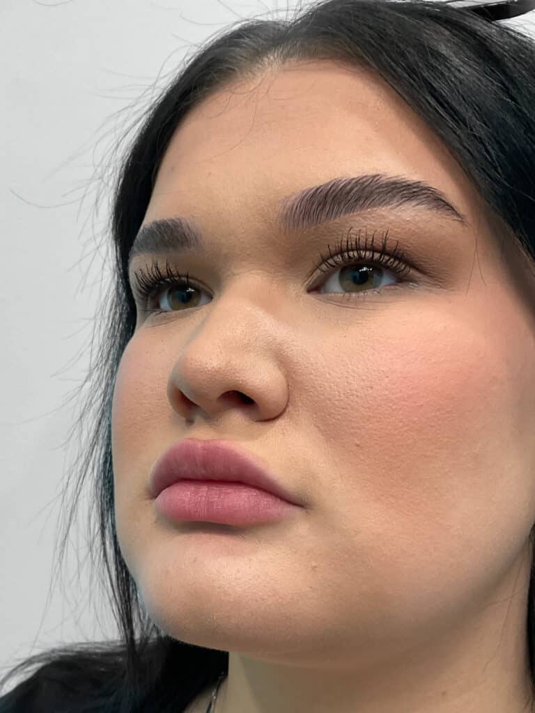 After Image: Lip Filler – Heather - left-front-oblique