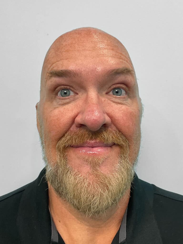 After Image: Botox – Heather - front