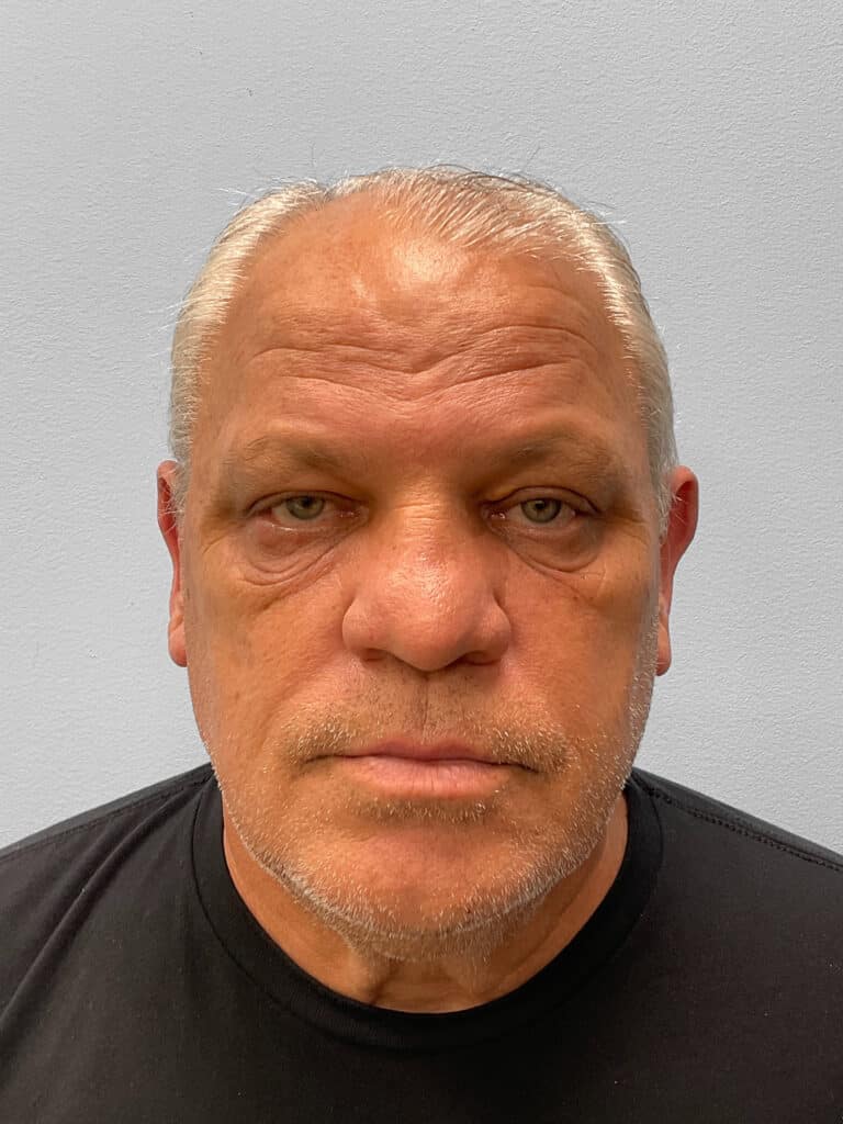 Before Image: Blepharoplasty – Dr. Tucker - front