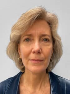 After Image: Facelift & Blepharoplasty – Dr. Tucker