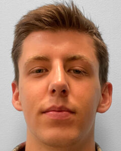 After Image: Rhinoplasty – Dr. Tucker