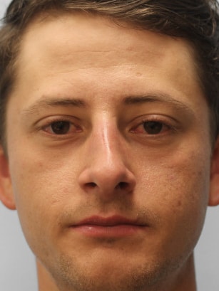 After Image: Rhinoplasty-Dr.Tucker - front