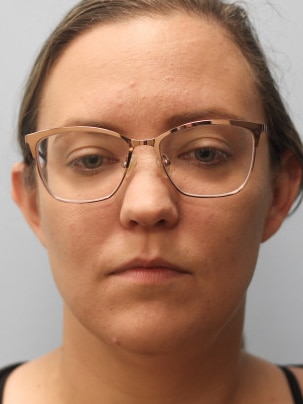 After Image: Kybella- Dr.Howell - front