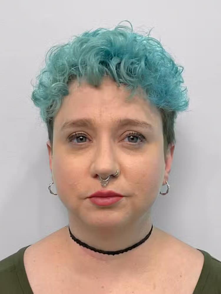 After Image: Restylane Kysse – Joy - front