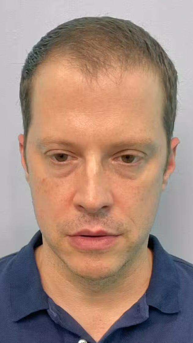 After Image: Botox- Joy - front