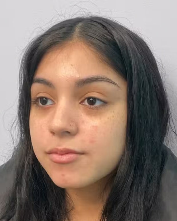 After Image: Juvéderm Ultra- Joy - left-front-oblique