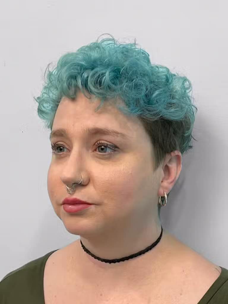 After Image: Restylane Kysse – Joy - left-front-oblique