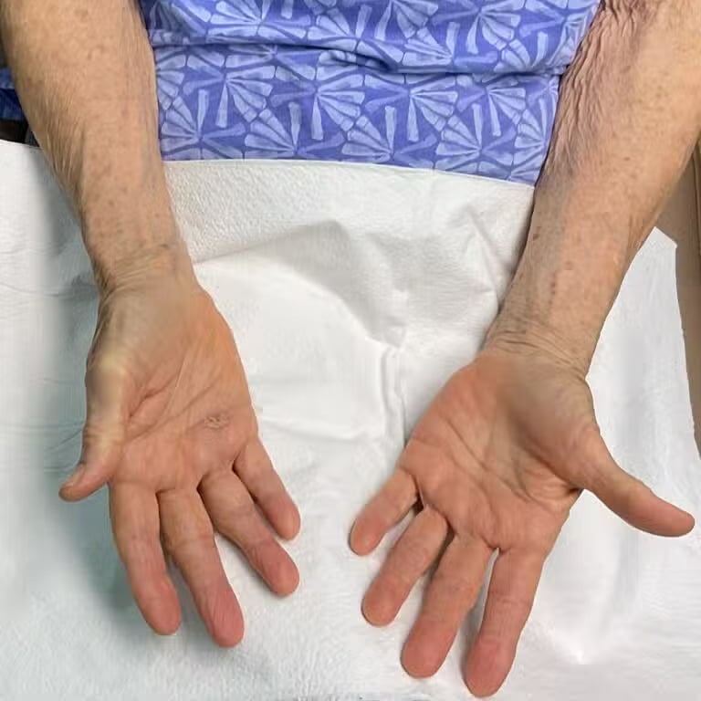 After Image: Laser Treatment- Jade - back