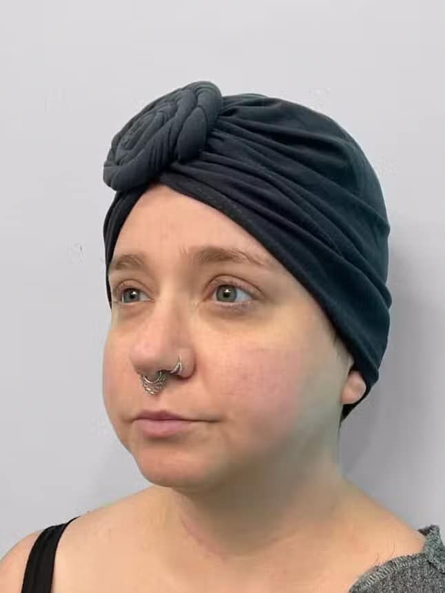 Before Image: Restylane Kysse – Joy - left-front-oblique