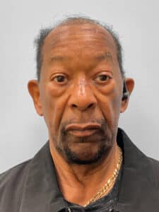 Before Image: Lower Blepharoplasty – Dr. Tucker