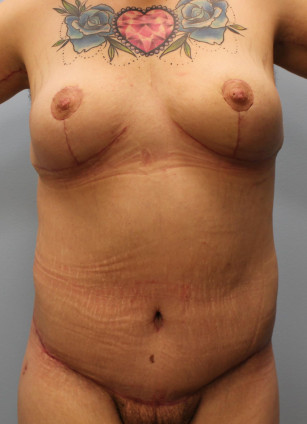 After Image