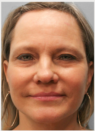 After Image