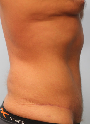 After Image