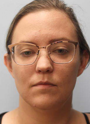 After Image: Kybella- Dr.Howell - front