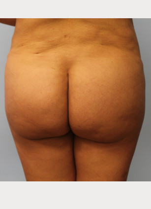 After Image
